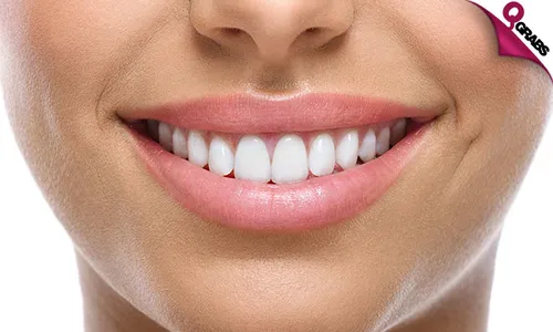 Hollywood Smile Veneers & Dental Implants!